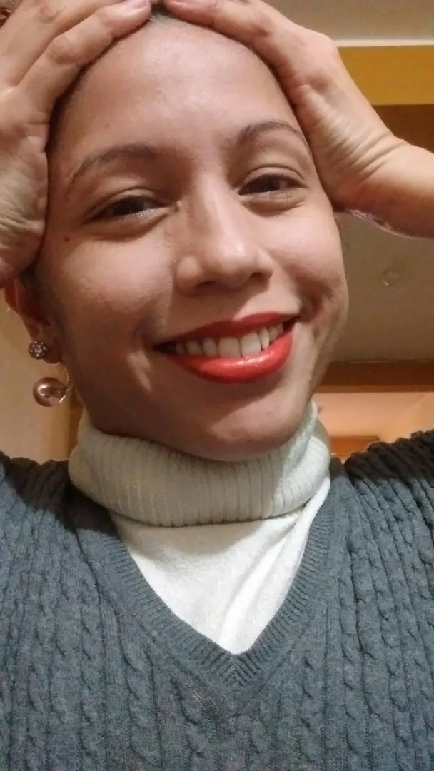 Natali. La alopecia areata es una enfermedad que causa la pérdida repentina de cabello y puede ser generada por un estrés excesivo. (Foto: )